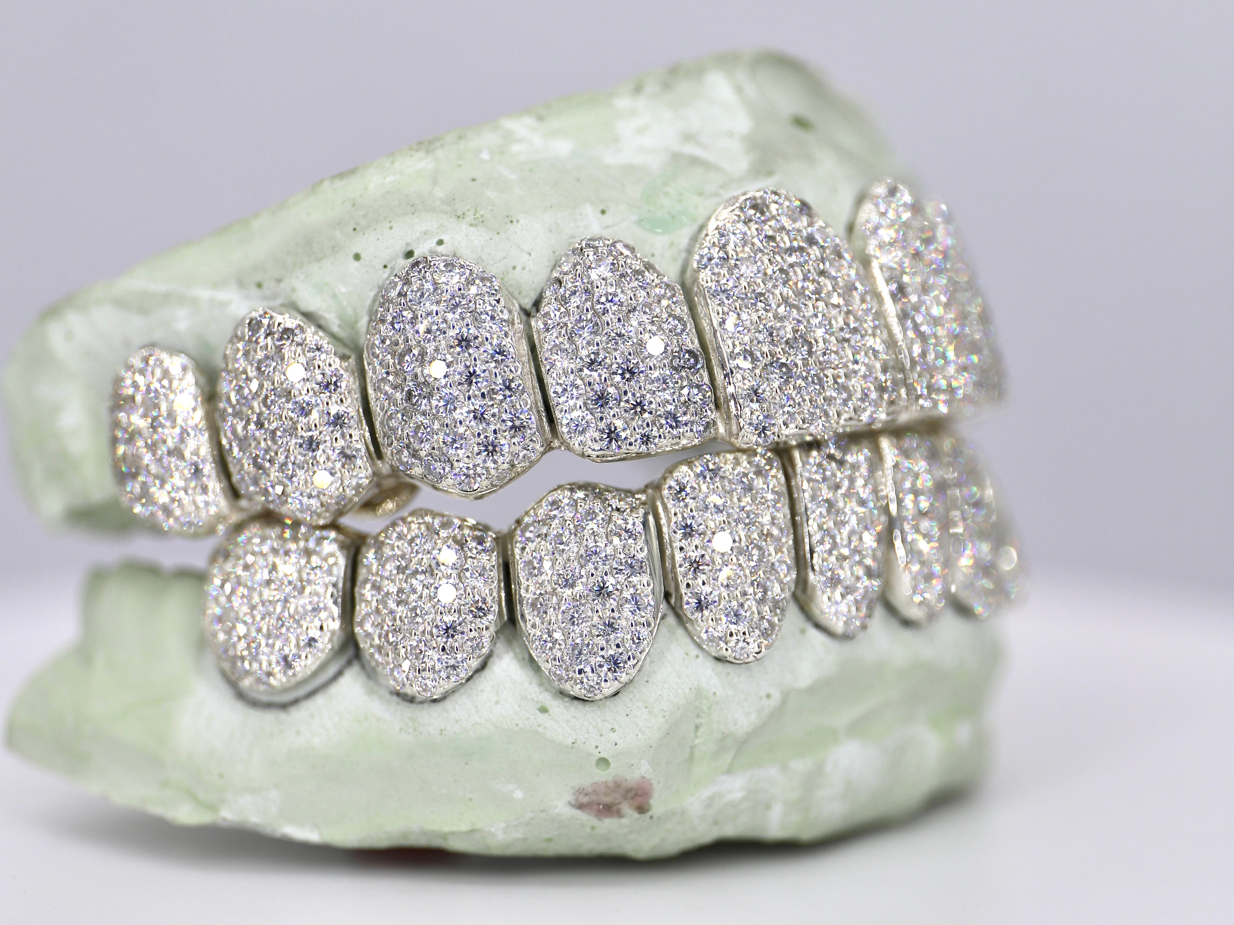 Diamond Dust Grillz – Moissanite Bazaar