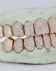 10 on 10 VVS Moisannite Diamond Grillz - Moissanite Bazaar - moissanitebazaar.com