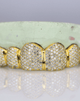 6 on 6 VVS Moissanite Diamond Grillz - Moissanite Bazaar - moissanitebazaar.com