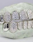 8 on 8 Capped VVS Moissanite Diamond Grillz - Moissanite Bazaar - moissanitebazaar.com