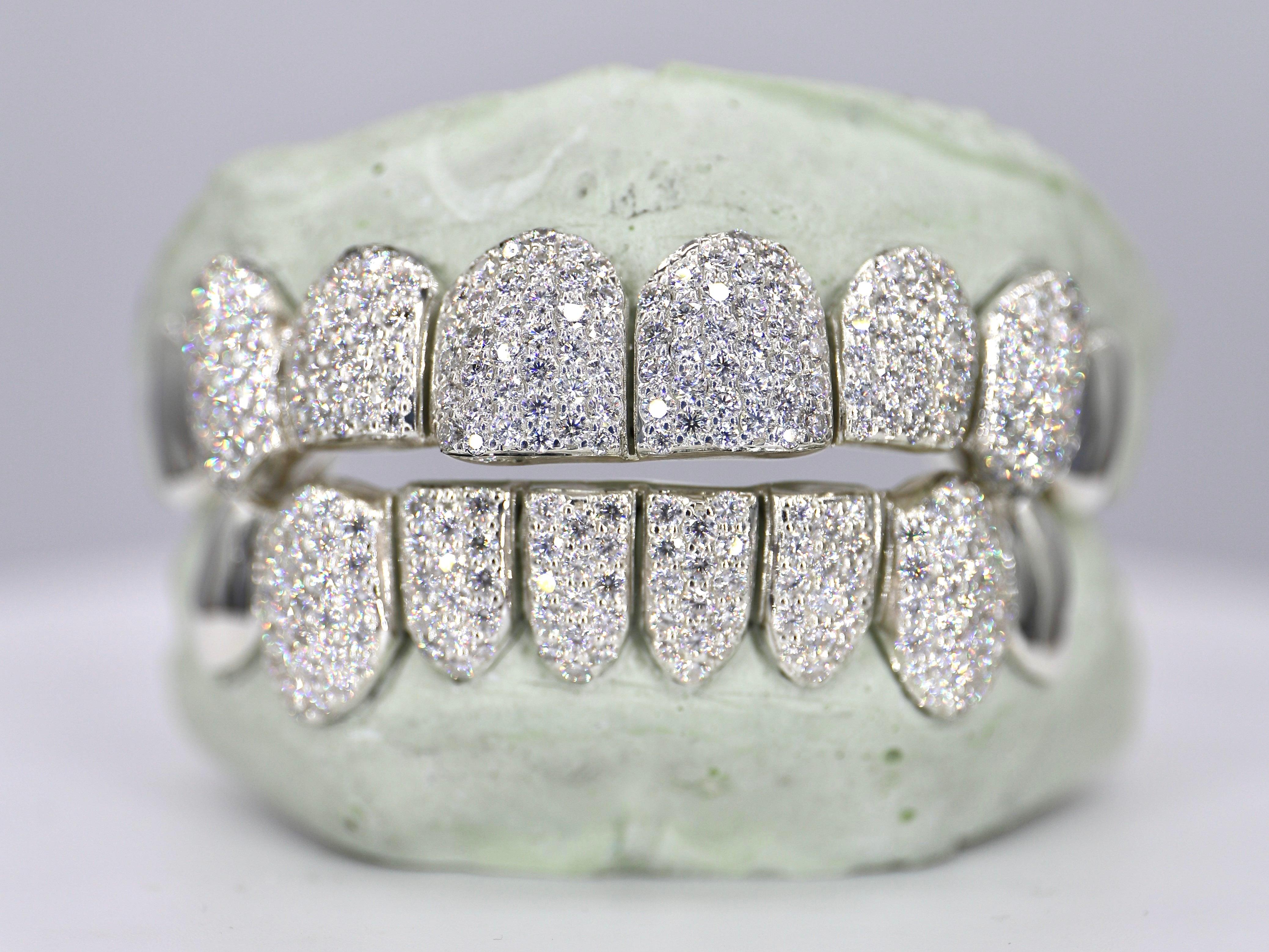 8 on 8 Capped VVS Moissanite Diamond Grillz - Moissanite Bazaar - moissanitebazaar.com
