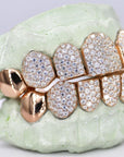 8 on 8 Capped VVS Moissanite Diamond Grillz - Moissanite Bazaar - moissanitebazaar.com