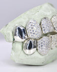 8 on 8 Capped VVS Moissanite Diamond Grillz - Moissanite Bazaar - moissanitebazaar.com