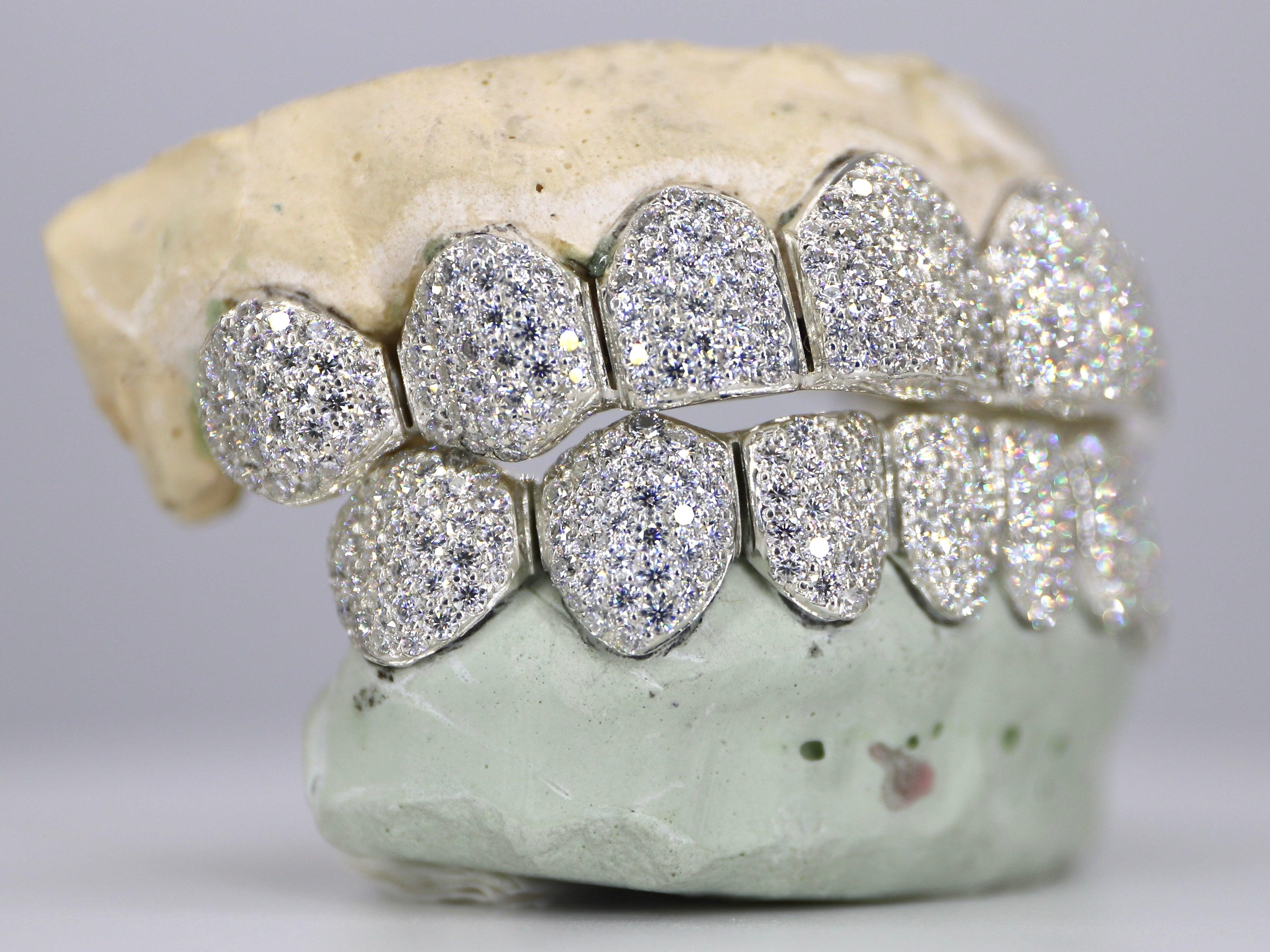 8 on 8 VVS Moissanite Diamond Grillz - Moissanite Bazaar - moissanitebazaar.com
