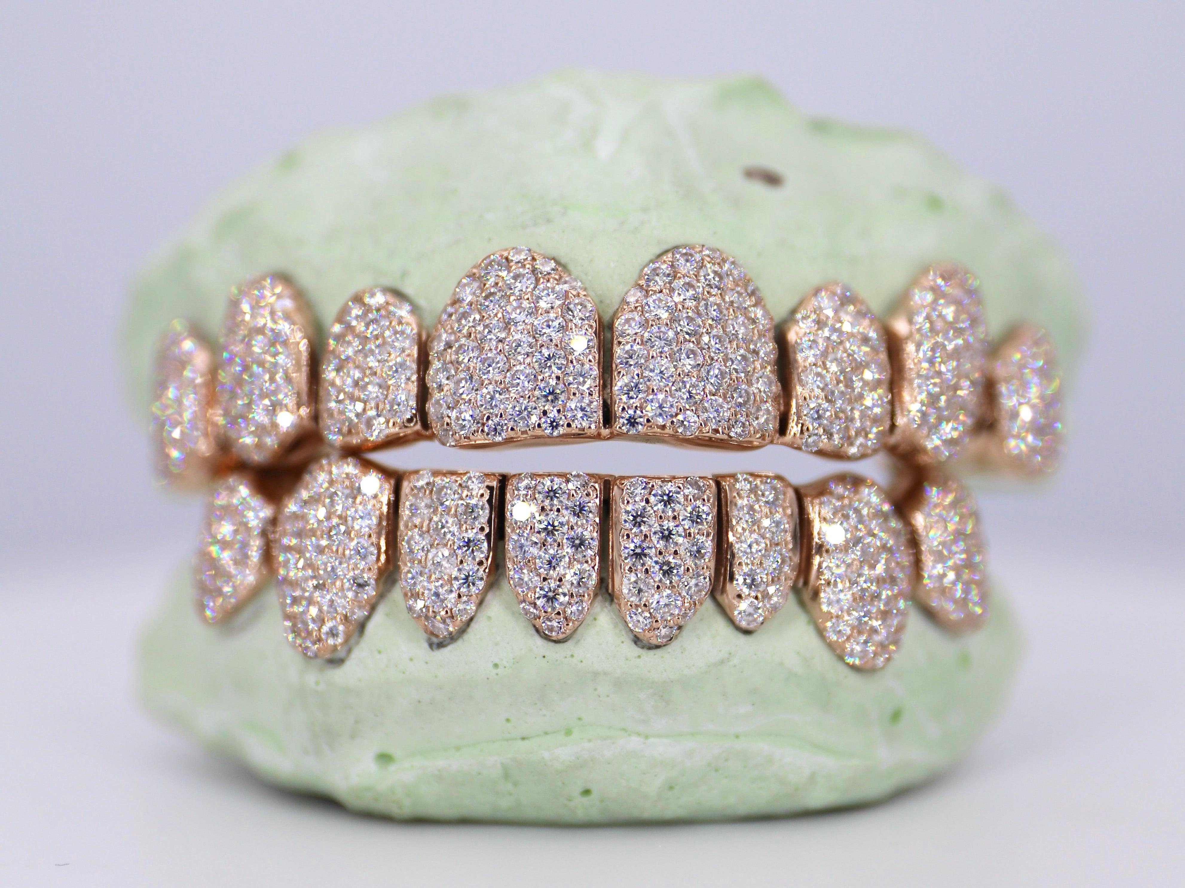 8 on 8 VVS Moissanite Diamond Grillz - Moissanite Bazaar - moissanitebazaar.com