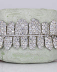 Jumbo VVS Moissanite Diamond Grillz - Moissanite Bazaar - moissanitebazaar.com
