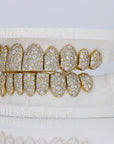 Mosaic/Snow VVS Moissanite Diamond Grillz - Moissanite Bazaar - moissanitebazaar.com