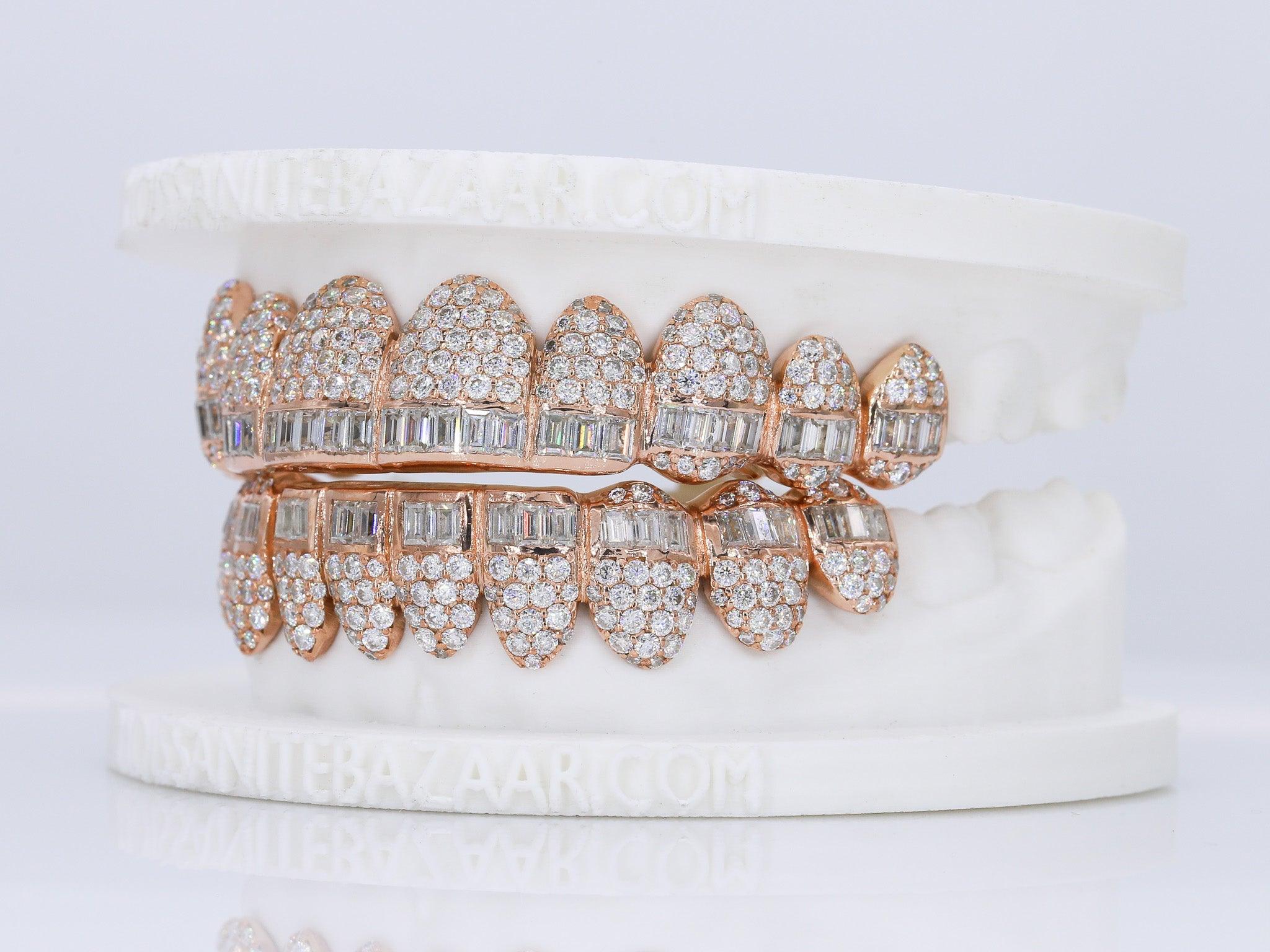 Baguette Hybrid VVS Moissanite Diamond Grillz - Moissanite Bazaar - moissanitebazaar.com