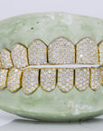 10 on 10 VVS Moisannite Diamond Grillz - Moissanite Bazaar - moissanitebazaar.com