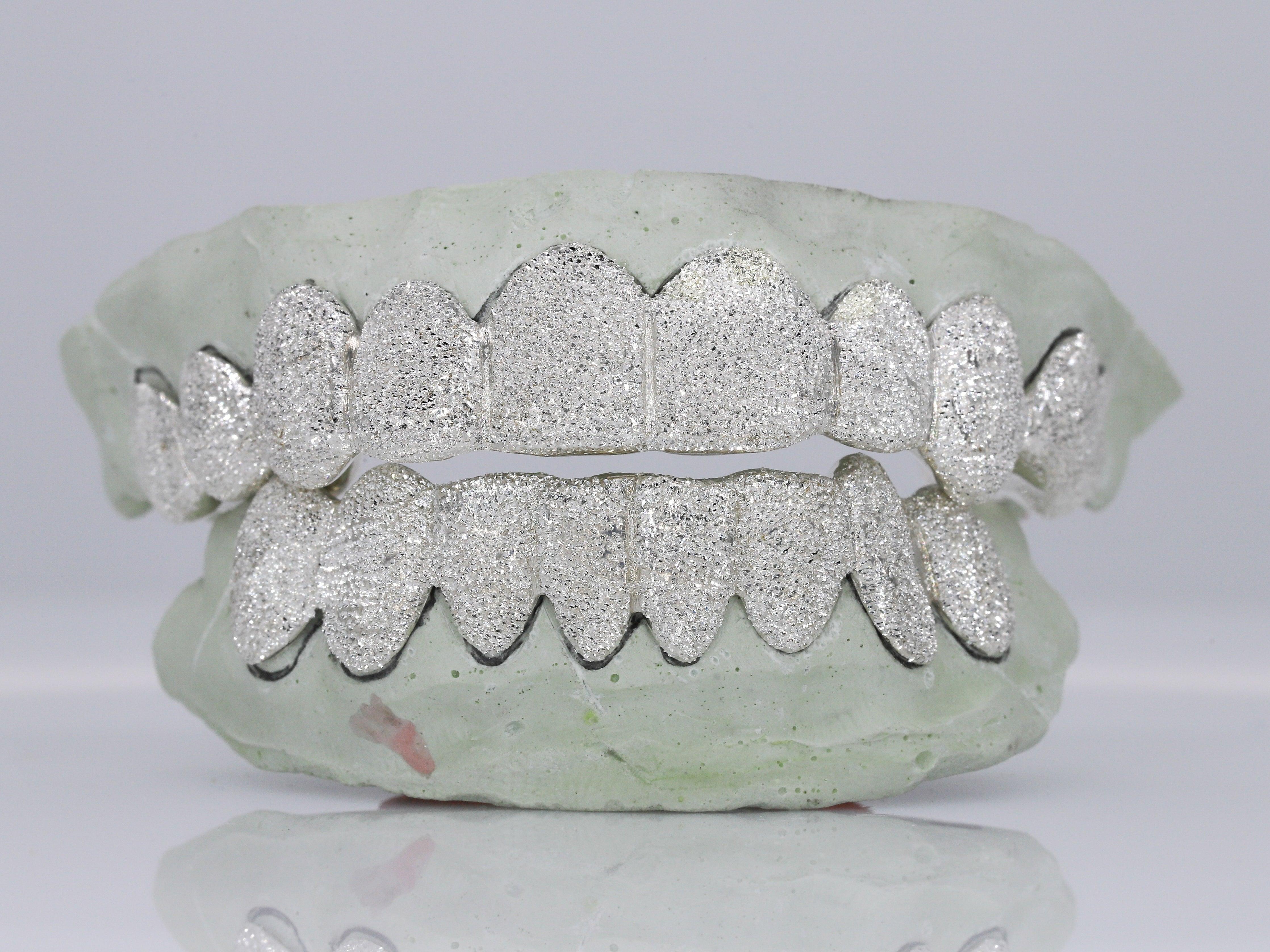 Diamond Dust Grillz - Moissanite Bazaar - moissanitebazaar.com