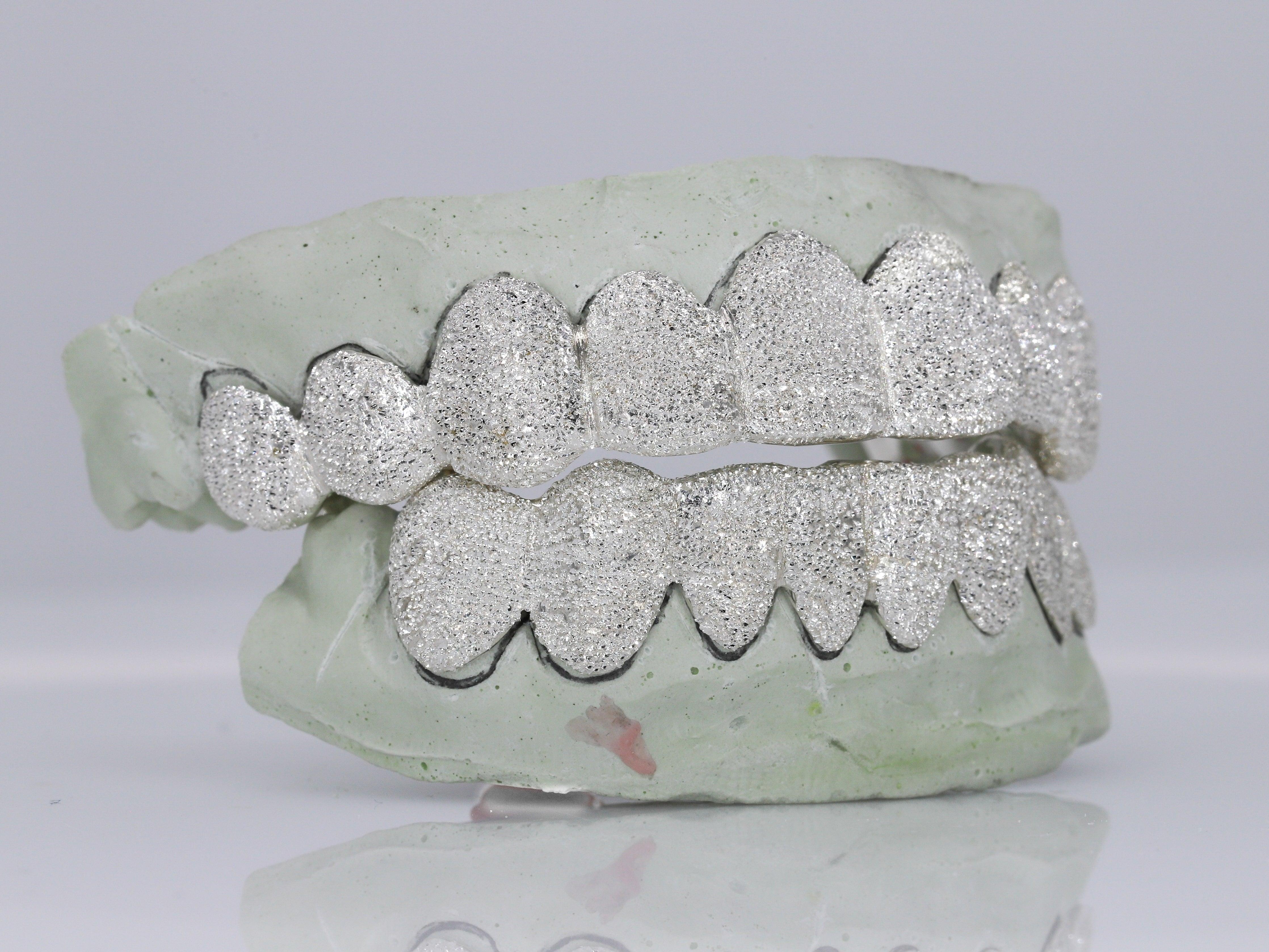 Diamond Dust Grillz - Moissanite Bazaar - moissanitebazaar.com