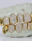 10 on 10 Capped VVS Moisannite Diamond Grillz - Moissanite Bazaar - moissanitebazaar.com