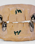Gold Fangs Grillz - Moissanite Bazaar - moissanitebazaar.com