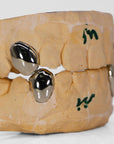Gold Fangs Grillz - Moissanite Bazaar - moissanitebazaar.com