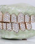 Jumbo VVS Moissanite Diamond Grillz - Moissanite Bazaar - moissanitebazaar.com