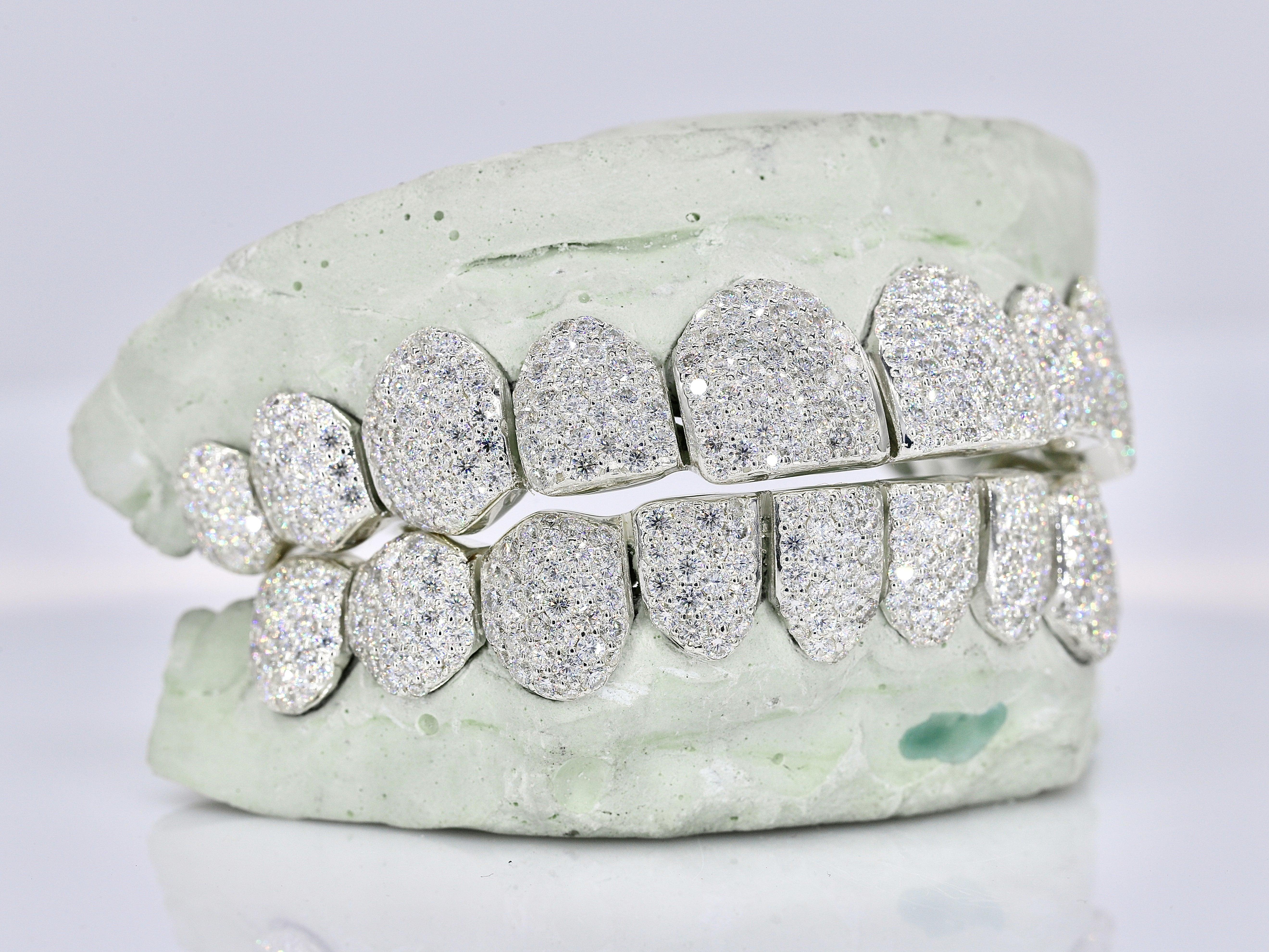 10 on 10 VVS Moisannite Diamond Grillz - Moissanite Bazaar - moissanitebazaar.com