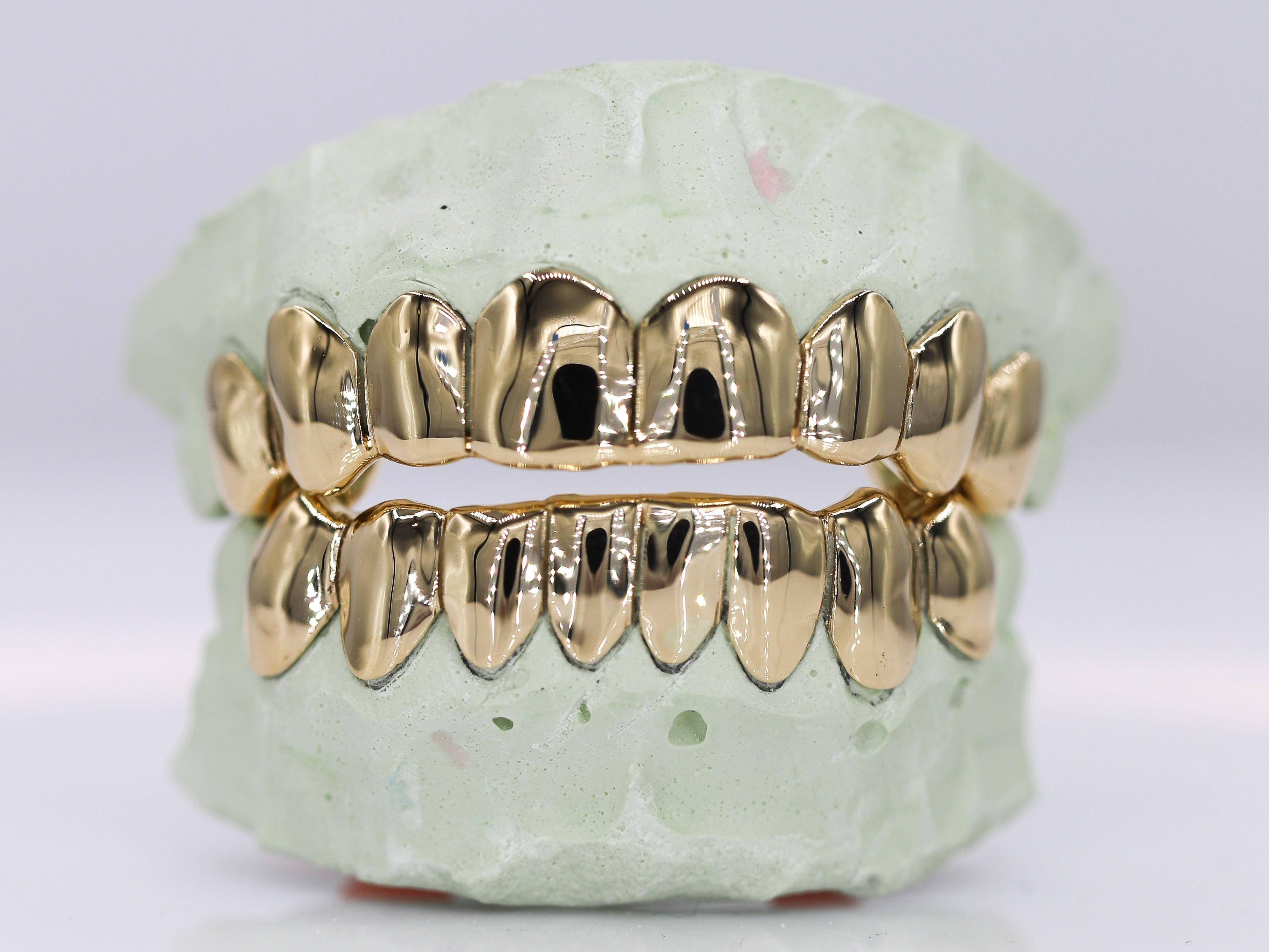 Solid Gold Grillz - Moissanite Bazaar - moissanitebazaar.com