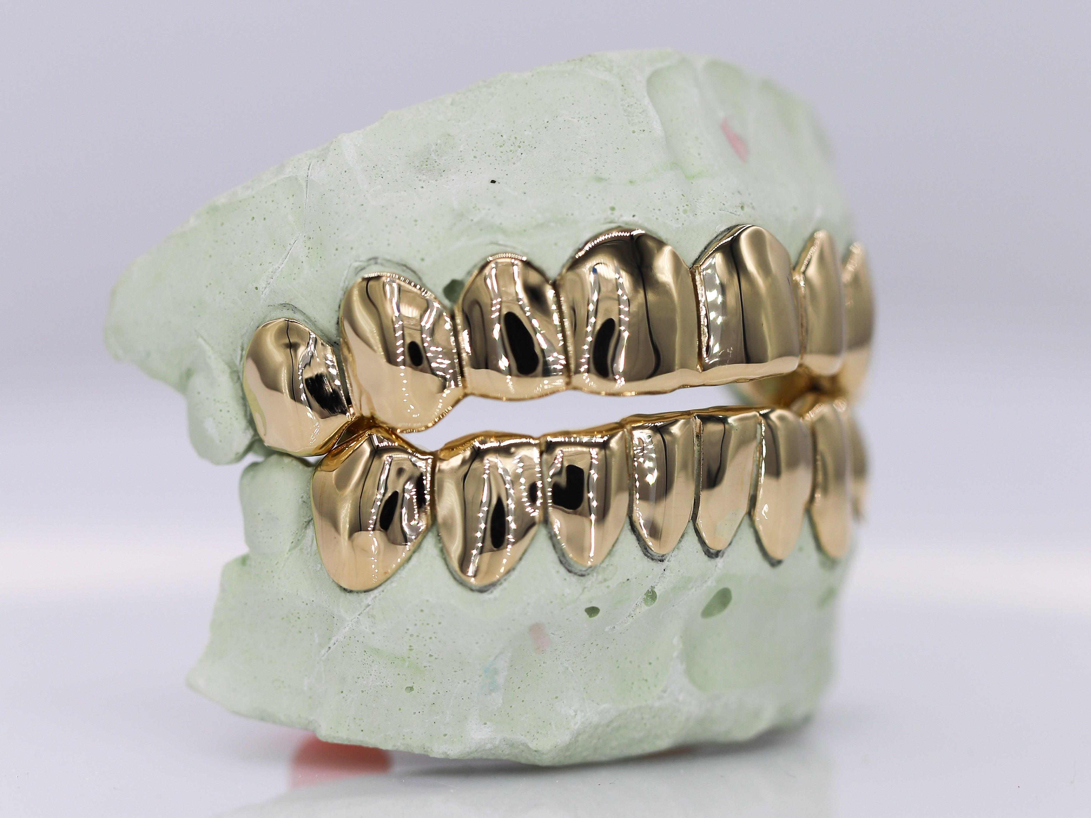 Solid Gold Grillz - Moissanite Bazaar - moissanitebazaar.com