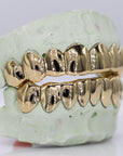 Solid Gold Grillz - Moissanite Bazaar - moissanitebazaar.com