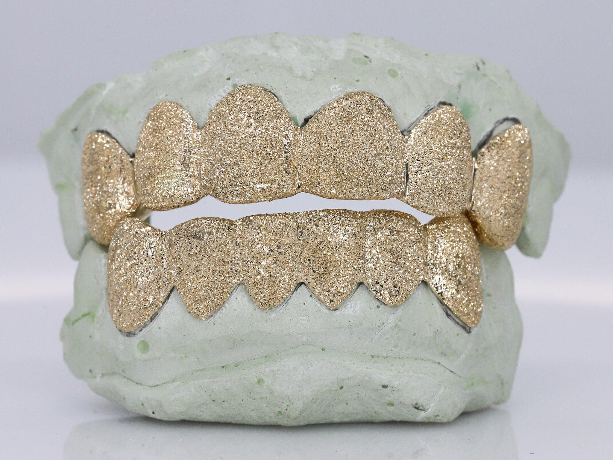 Diamond Dust Grillz - Moissanite Bazaar - moissanitebazaar.com