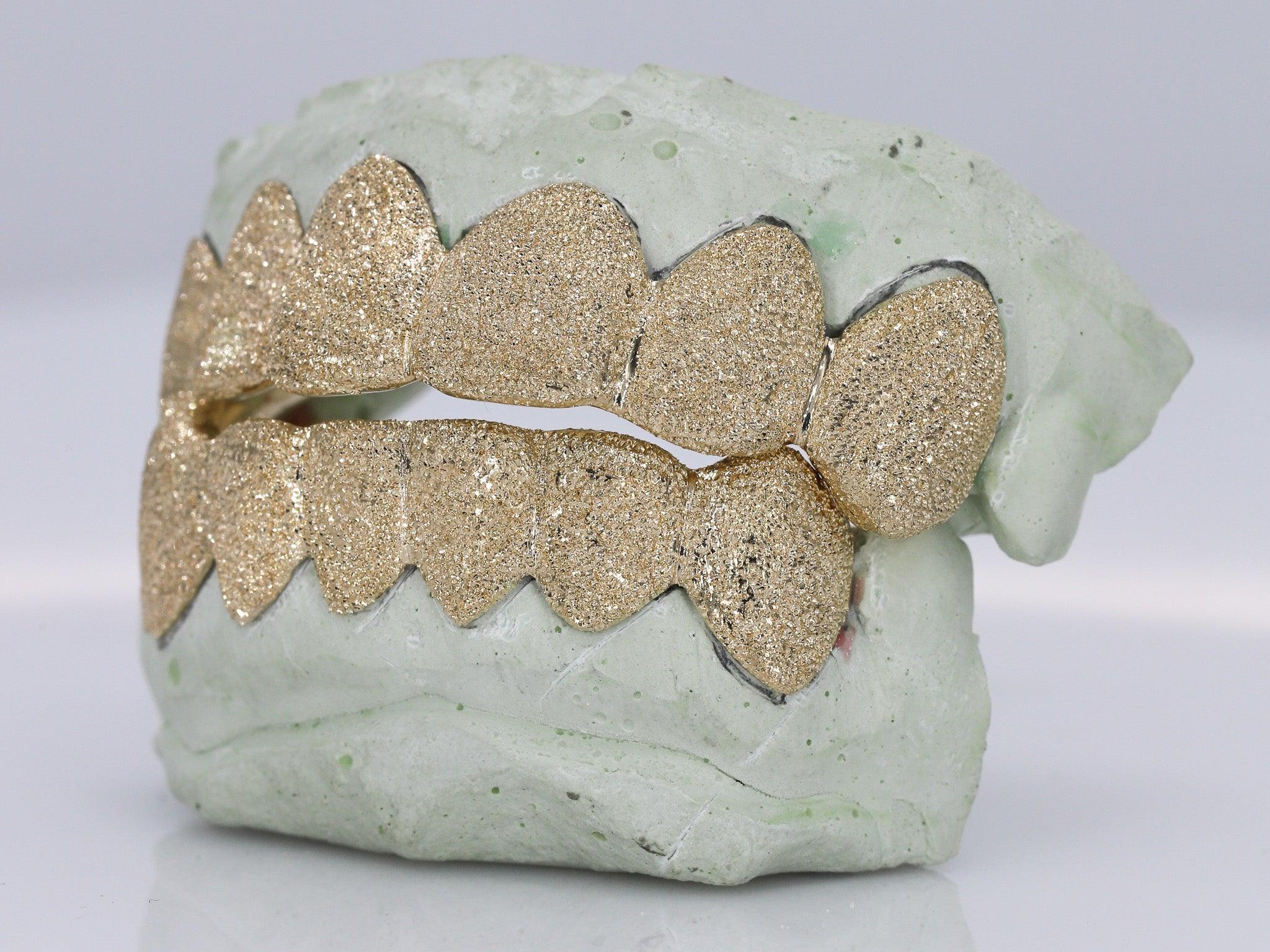 Diamond Dust Grillz - Moissanite Bazaar - moissanitebazaar.com
