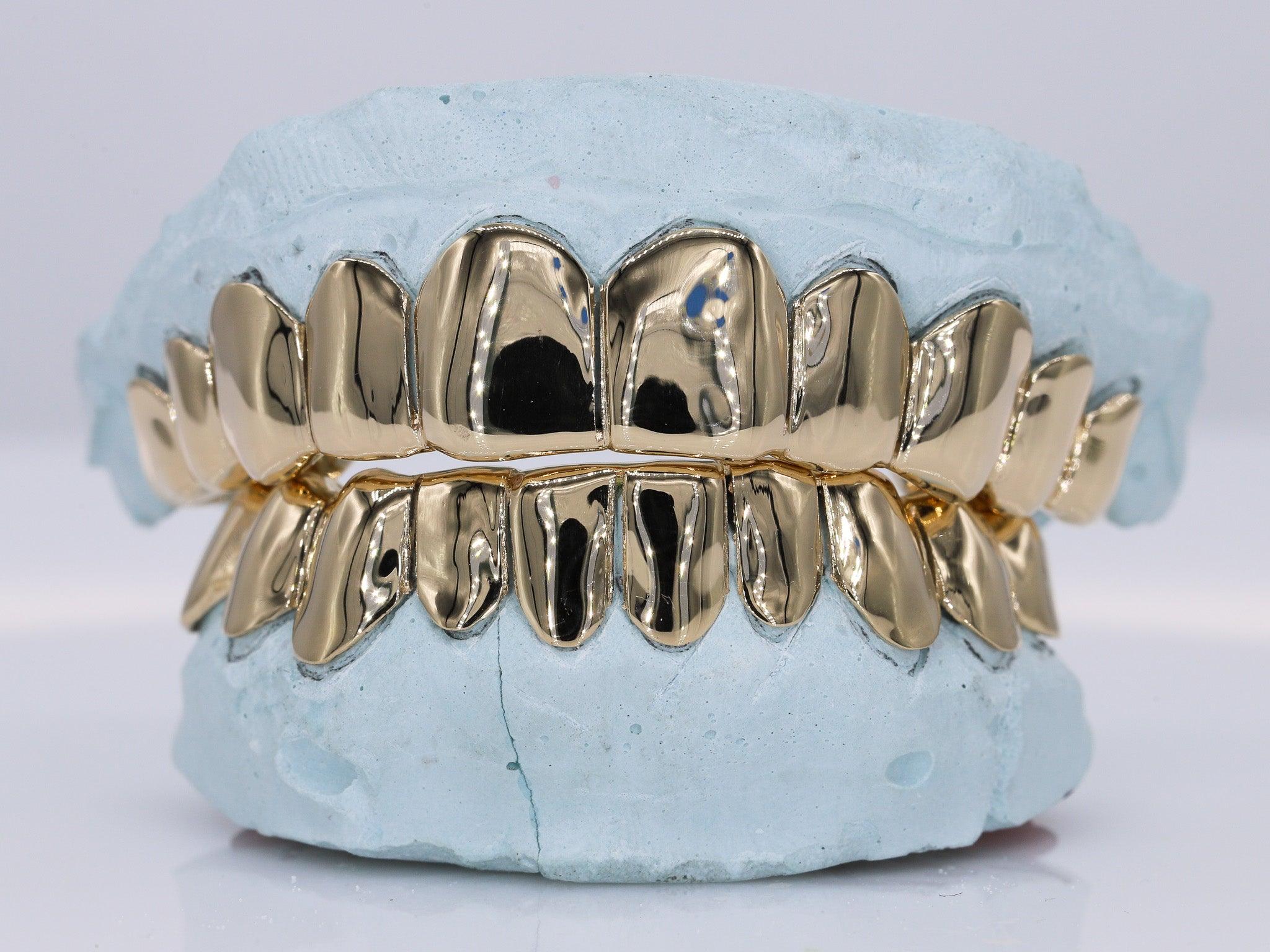 Solid Gold Grillz - Moissanite Bazaar - moissanitebazaar.com