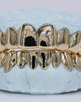 Solid Gold Grillz - Moissanite Bazaar - moissanitebazaar.com