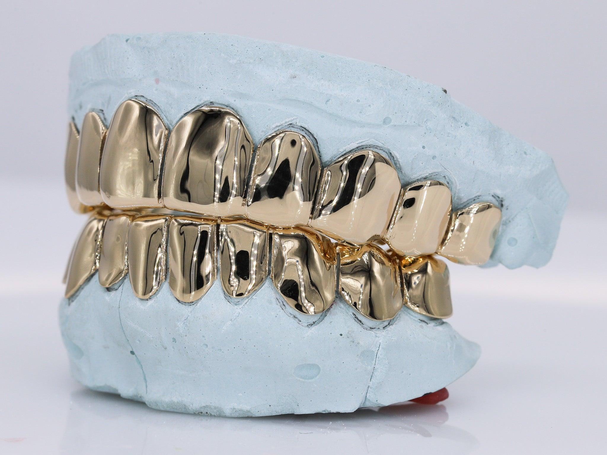 Solid Gold Grillz - Moissanite Bazaar - moissanitebazaar.com