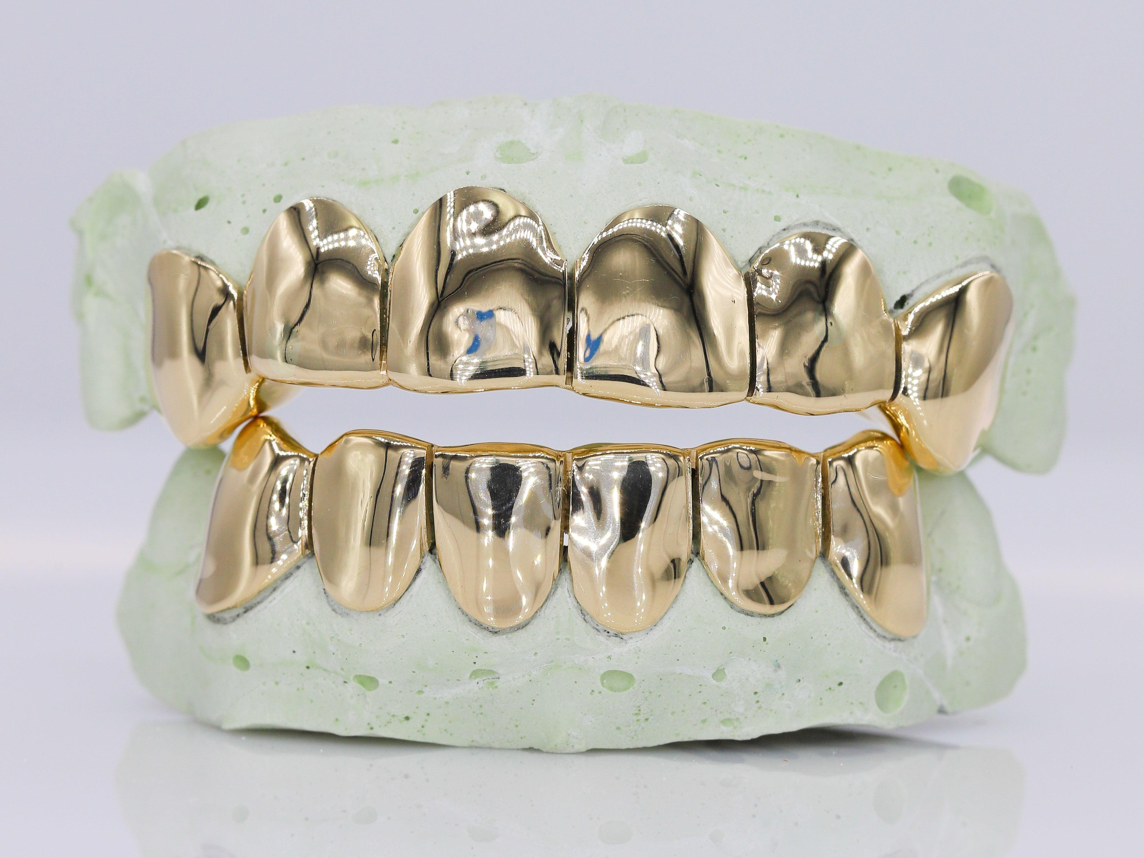 Solid Gold Grillz - Moissanite Bazaar - moissanitebazaar.com