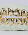 Solid Gold Grillz - Moissanite Bazaar - moissanitebazaar.com