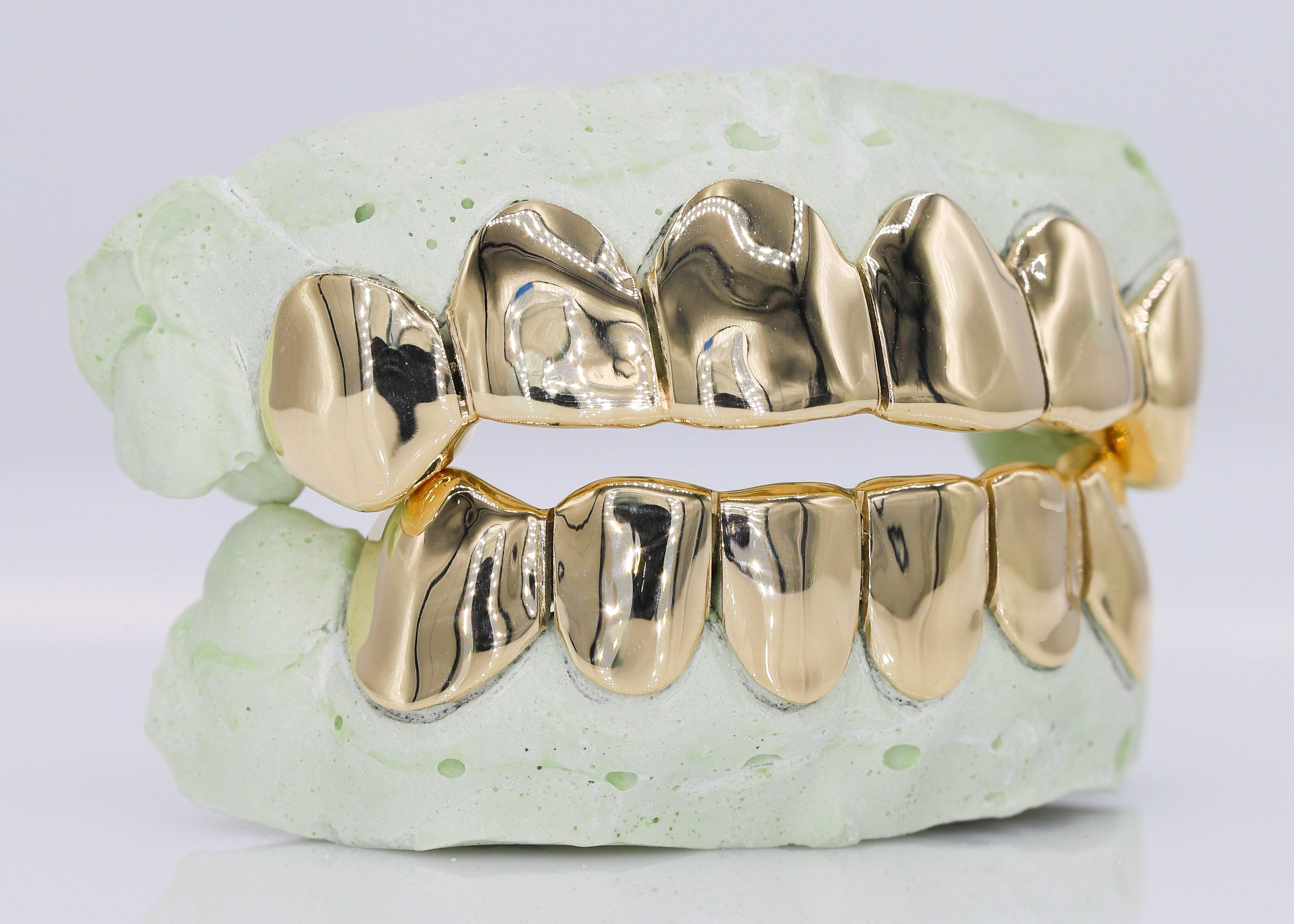 Solid Gold Grillz - Moissanite Bazaar - moissanitebazaar.com