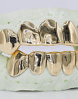Solid Gold Grillz - Moissanite Bazaar - moissanitebazaar.com