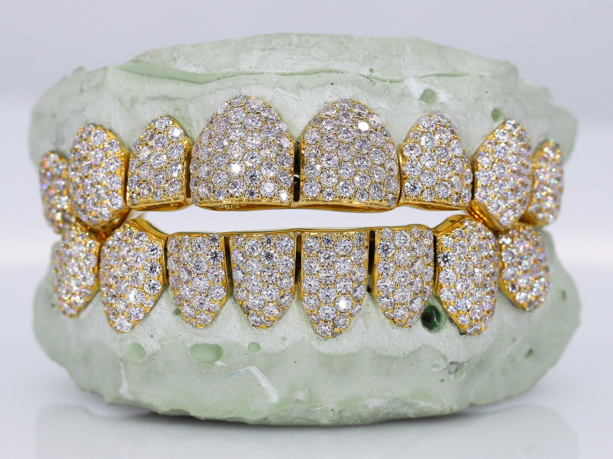 Custom Grillz, FREE Diamond Dust, 925 Silver Real 14K Gold , FREE Mold  Kits, Fast Process, FREE 2 Day Shipping by Grillz Jewelry 