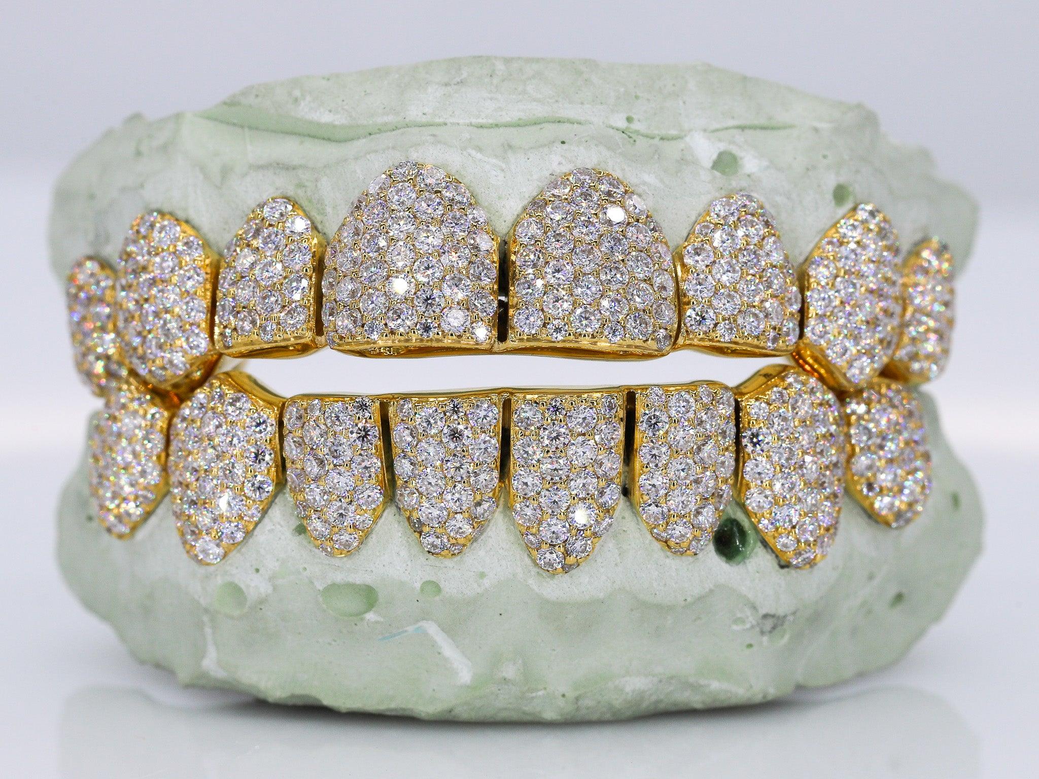 8 on 8 VVS Moissanite Diamond Grillz - Moissanite Bazaar - moissanitebazaar.com