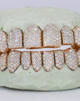 10 on 10 Capped VVS Moisannite Diamond Grillz - Moissanite Bazaar - moissanitebazaar.com