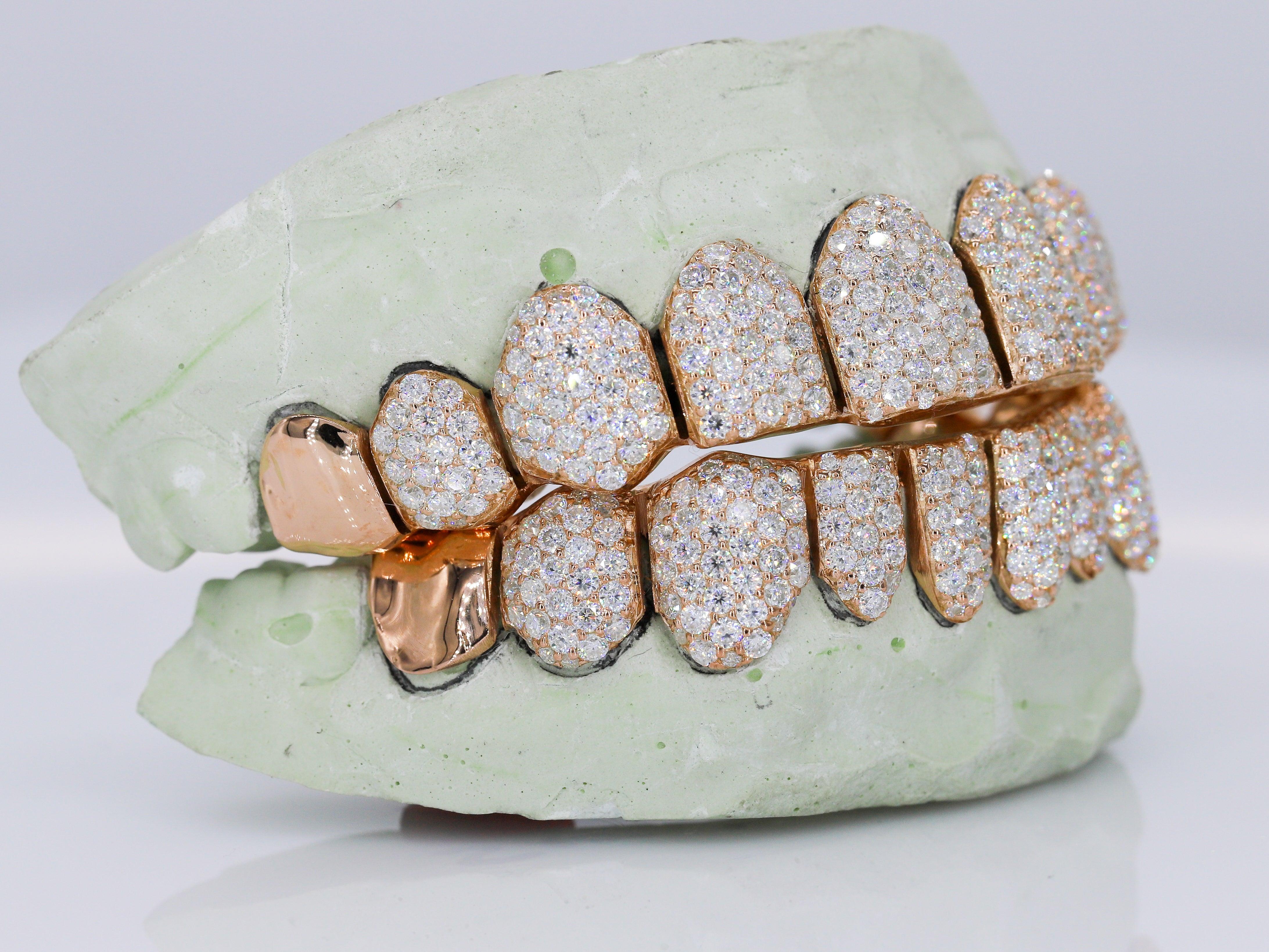 Rose gold diamond on sale grillz