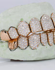 10 on 10 Capped VVS Moisannite Diamond Grillz - Moissanite Bazaar - moissanitebazaar.com