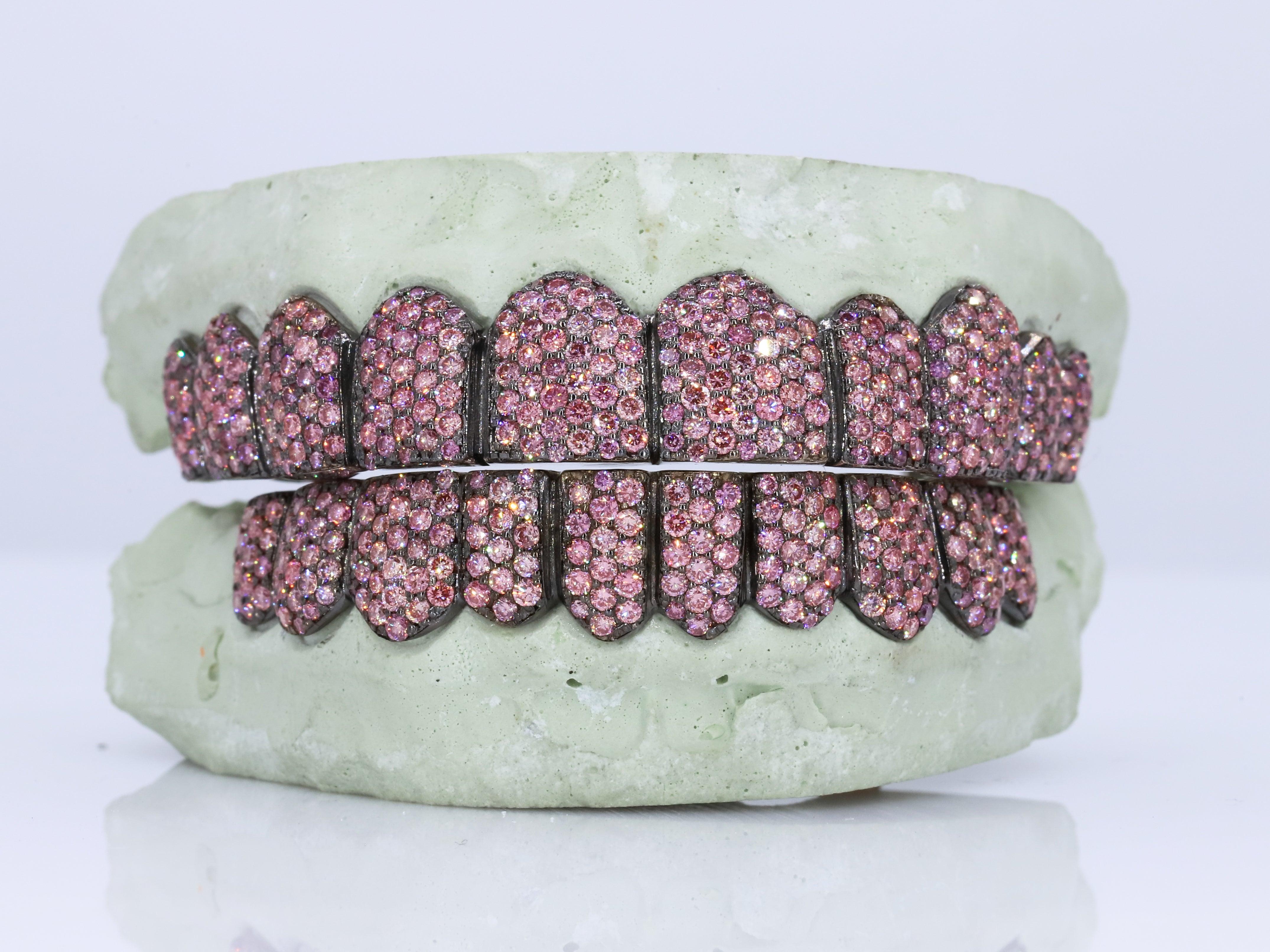 VVS Purple Lab Diamond Grillz – Moissanite Bazaar