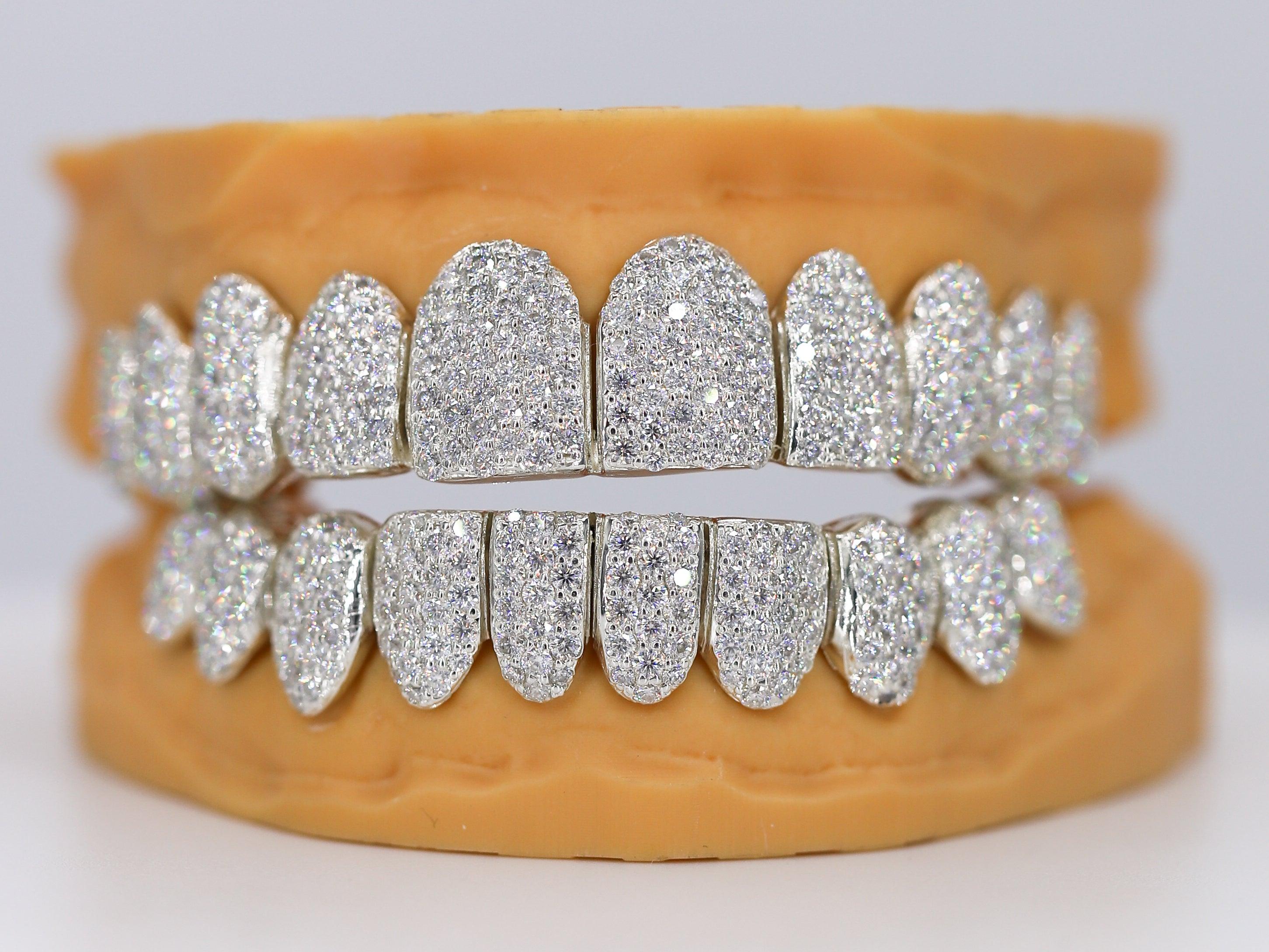 Custom Permanent VVS Moissanite Diamond Grillz - Moissanite Bazaar - moissanitebazaar.com