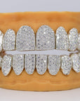 Custom Permanent VVS Moissanite Diamond Grillz - Moissanite Bazaar - moissanitebazaar.com