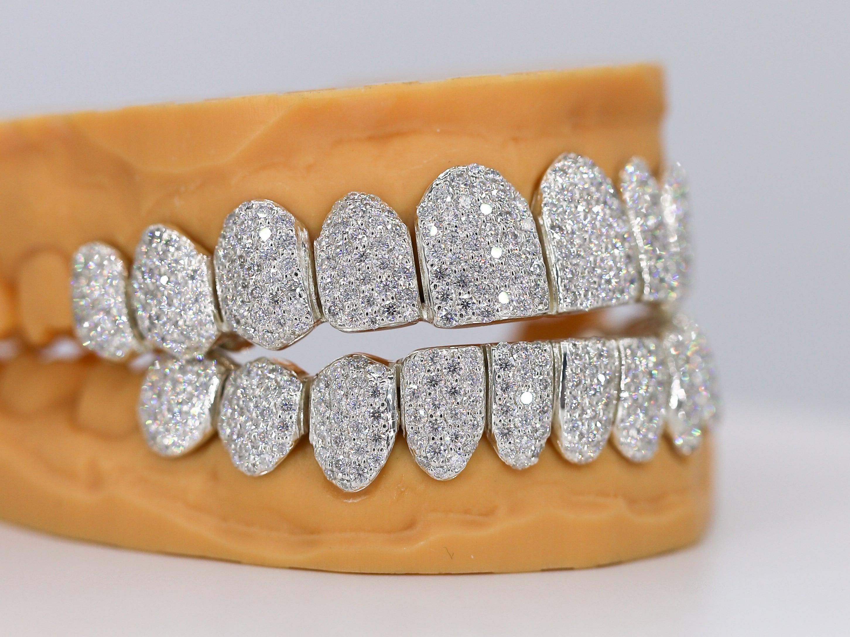 Custom Permanent VVS Moissanite Diamond Grillz - Moissanite Bazaar - moissanitebazaar.com