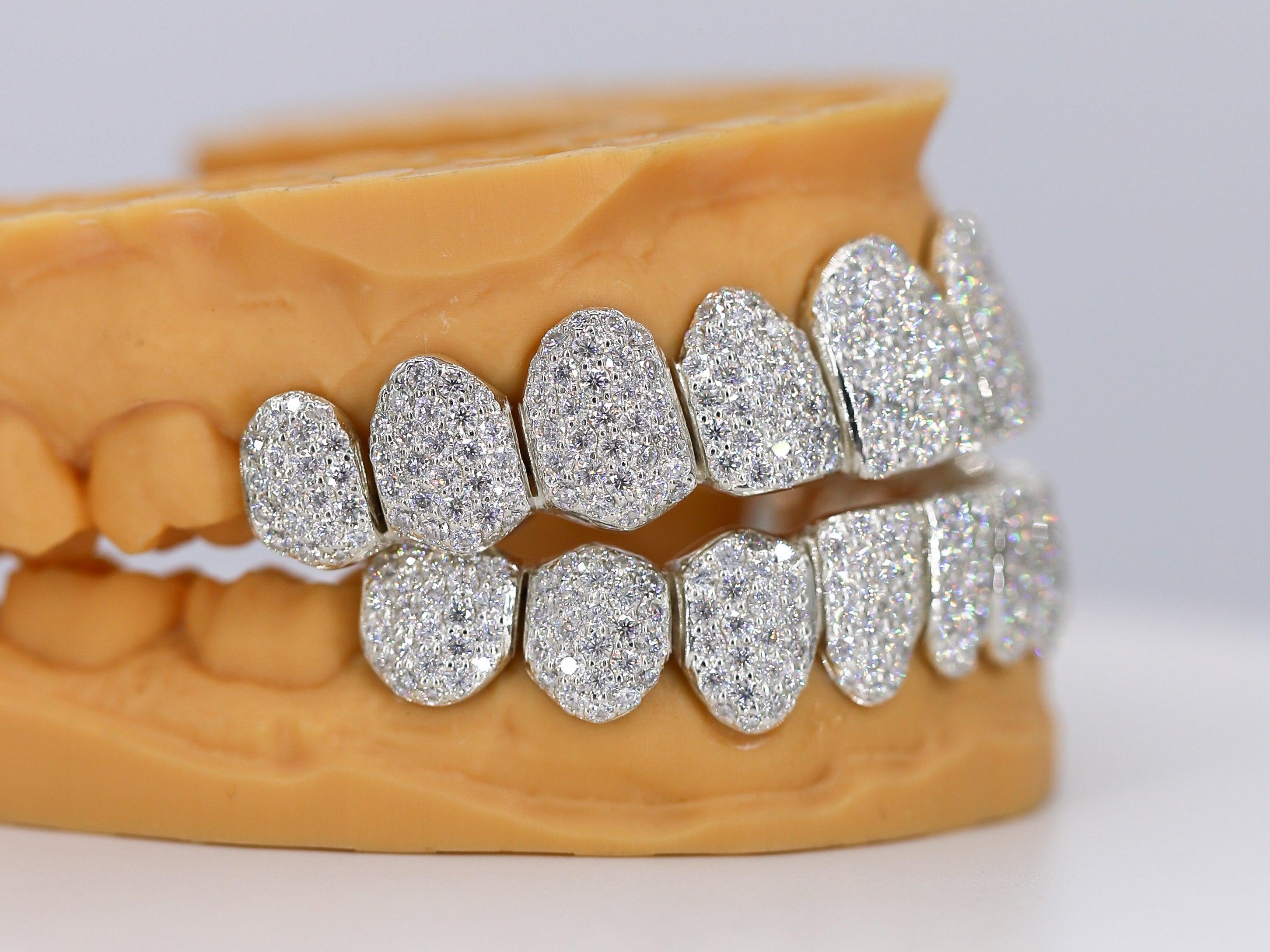Custom Permanent VVS Moissanite Diamond Grillz - Moissanite Bazaar - moissanitebazaar.com