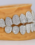 Custom Permanent VVS Moissanite Diamond Grillz - Moissanite Bazaar - moissanitebazaar.com