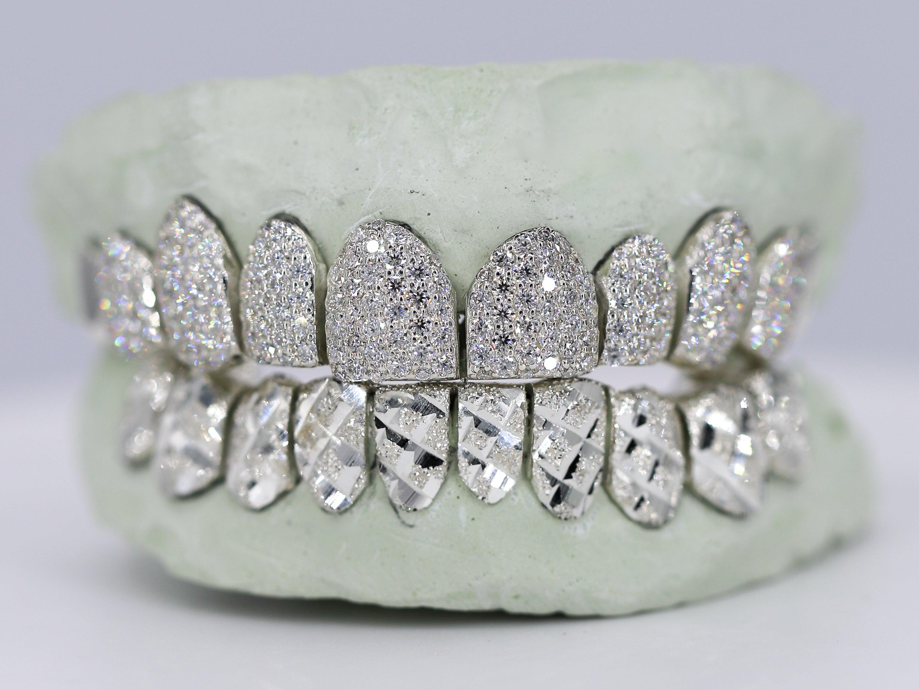 Diamond Top and Diamond Cut Bottom VVS Moisannite Diamond Grillz - Moissanite Bazaar - moissanitebazaar.com