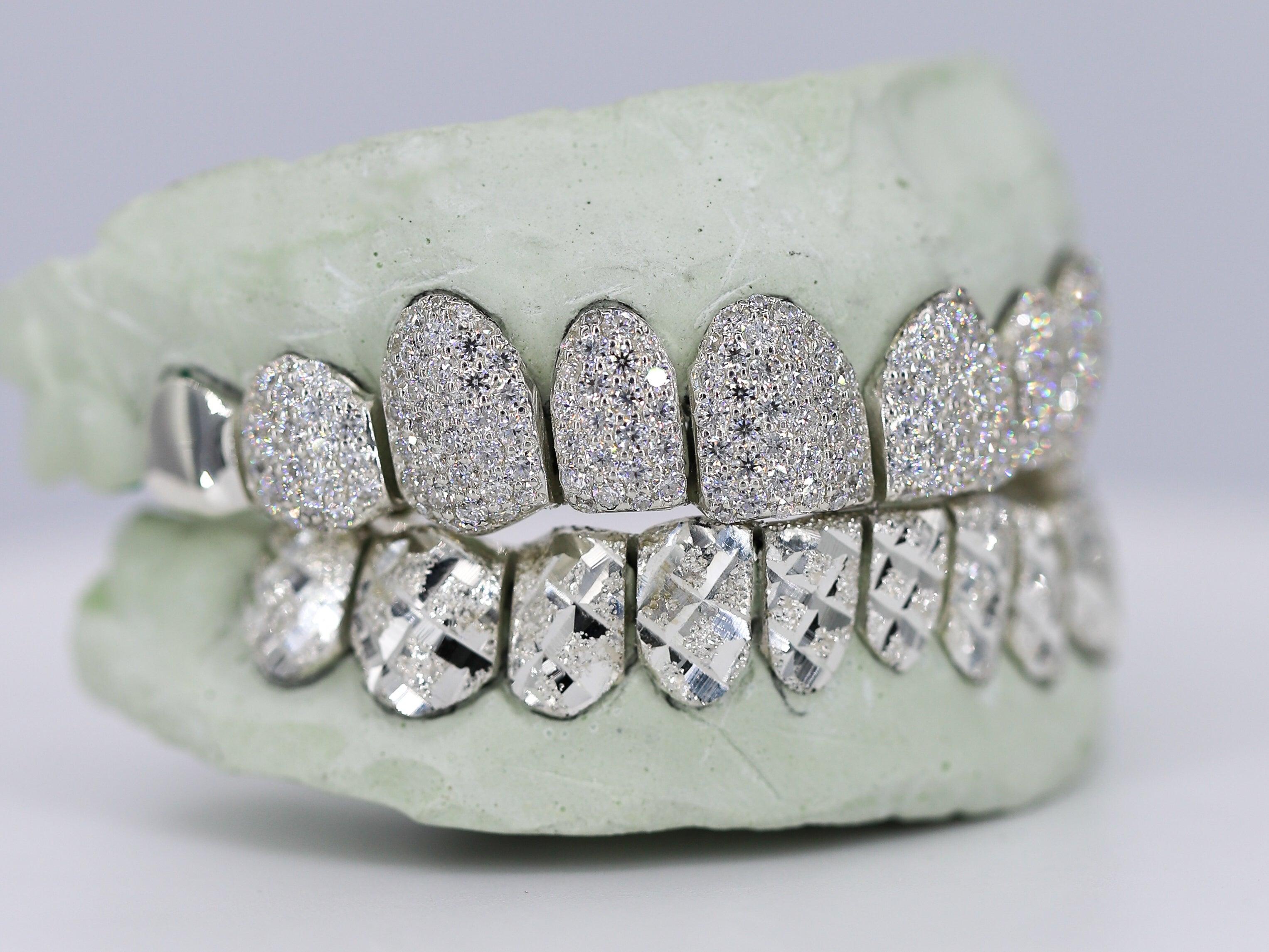 Diamond Top and Diamond Cut Bottom VVS Moisannite Diamond Grillz - Moissanite Bazaar - moissanitebazaar.com