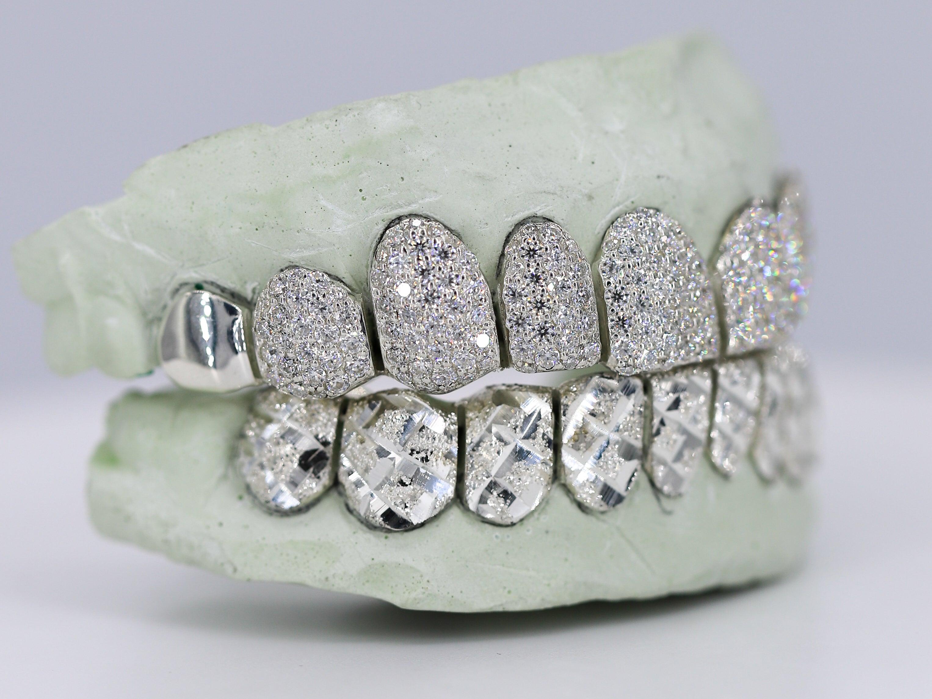 Diamond Top and Diamond Cut Bottom VVS Moisannite Diamond Grillz - Moissanite Bazaar - moissanitebazaar.com