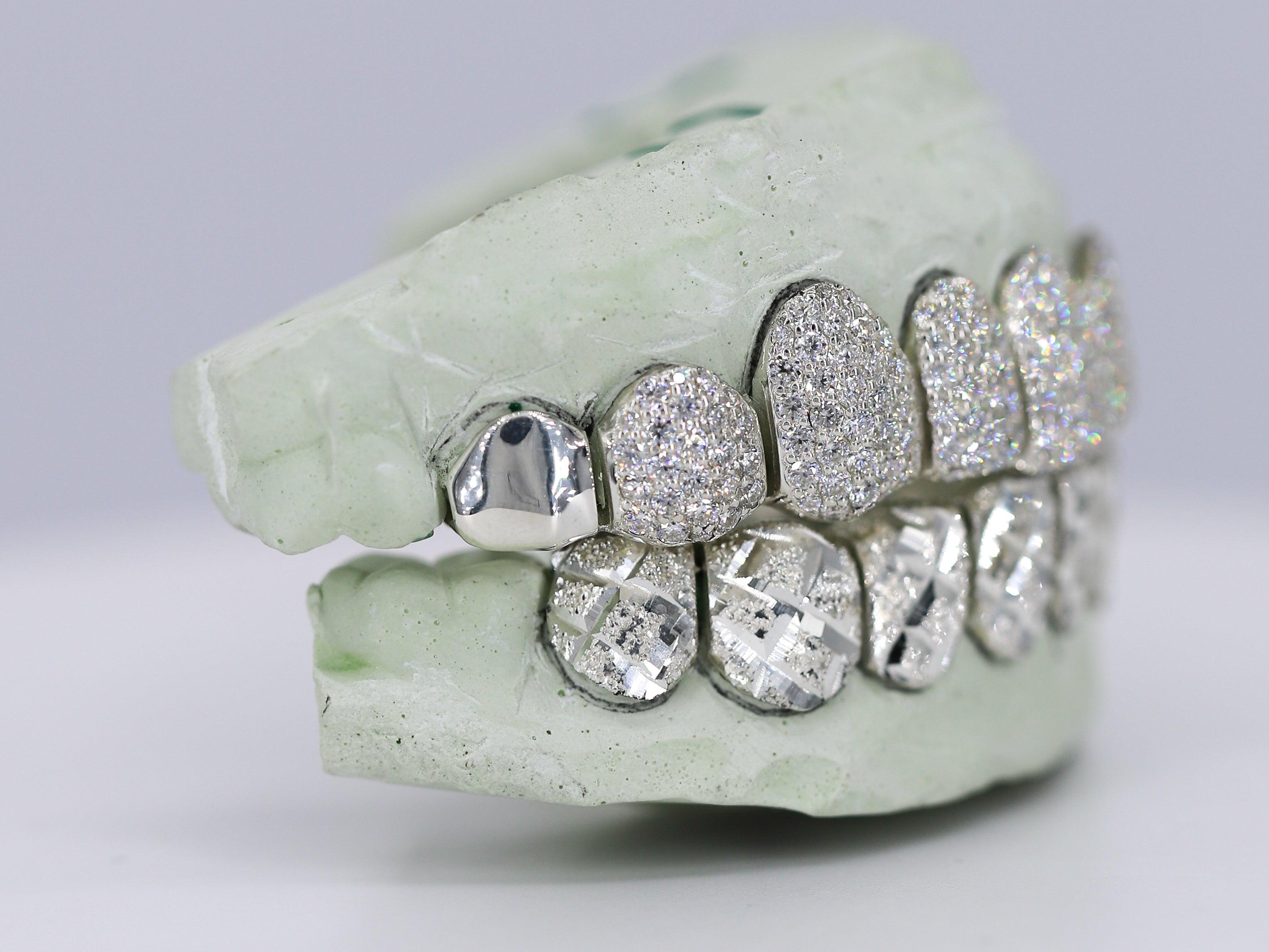 Diamond Top and Diamond Cut Bottom VVS Moisannite Diamond Grillz - Moissanite Bazaar - moissanitebazaar.com
