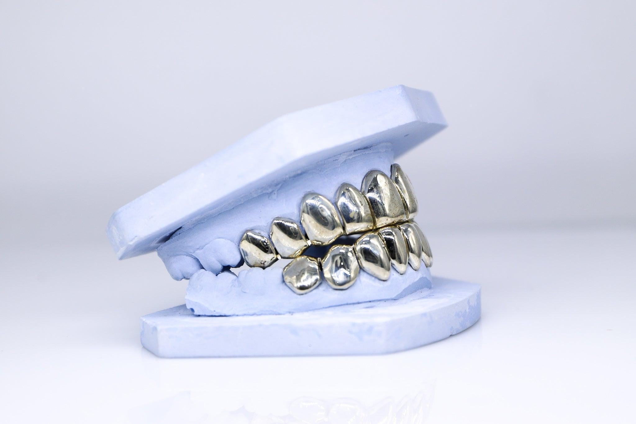 Solid Gold Grillz - Moissanite Bazaar - moissanitebazaar.com