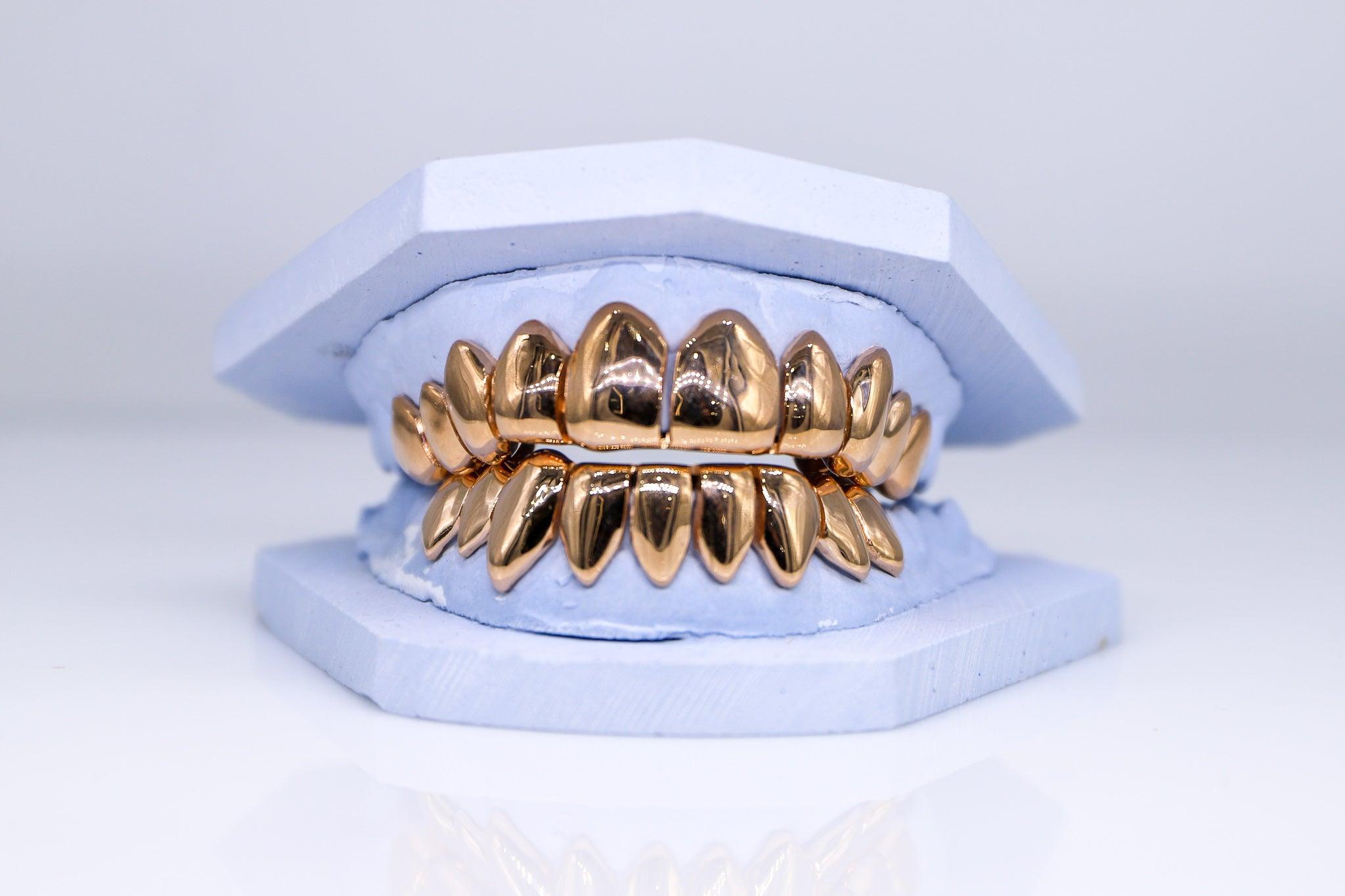 Solid Gold Grillz - Moissanite Bazaar - moissanitebazaar.com