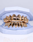 Solid Gold Grillz - Moissanite Bazaar - moissanitebazaar.com